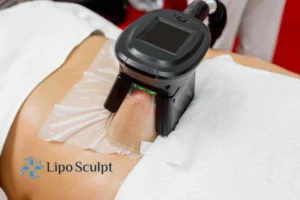 Are The Results From Aqualyx Permanent? 4 Compare Aqualyx Daventry to other fat reduction treatments.