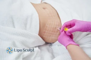 Are The Results From Aqualyx Permanent? 1 Do you want to know how long Aqualyx Daventry results last?