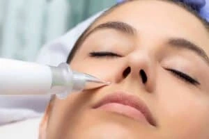 Best Actinic Keratoses Removal 3 Actinic keratoses Daventry solutions - book in today!